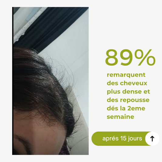 hair growth vitamin spray