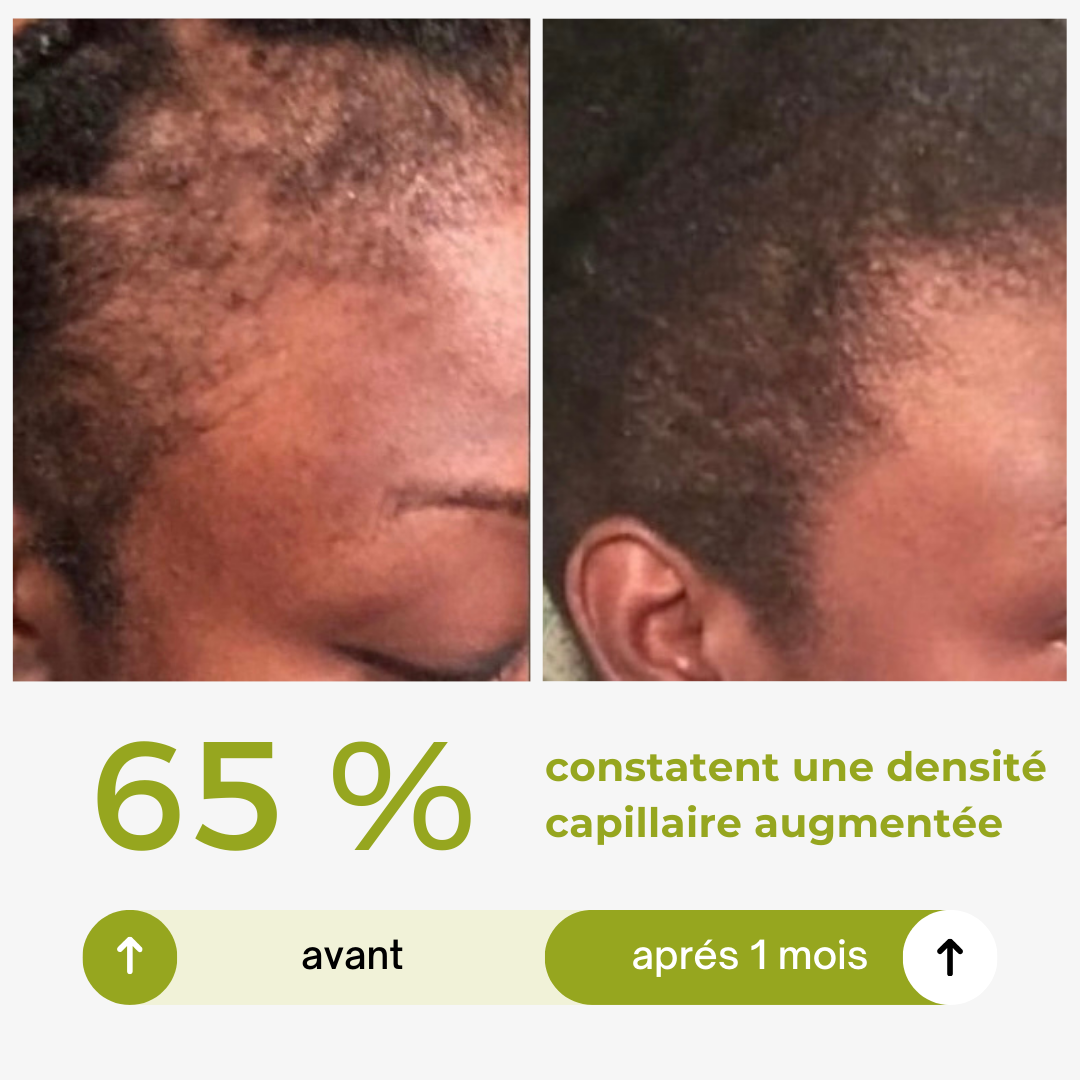 Herbal hair growth serum