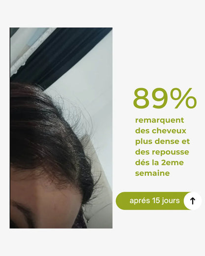 herbal hair growth box