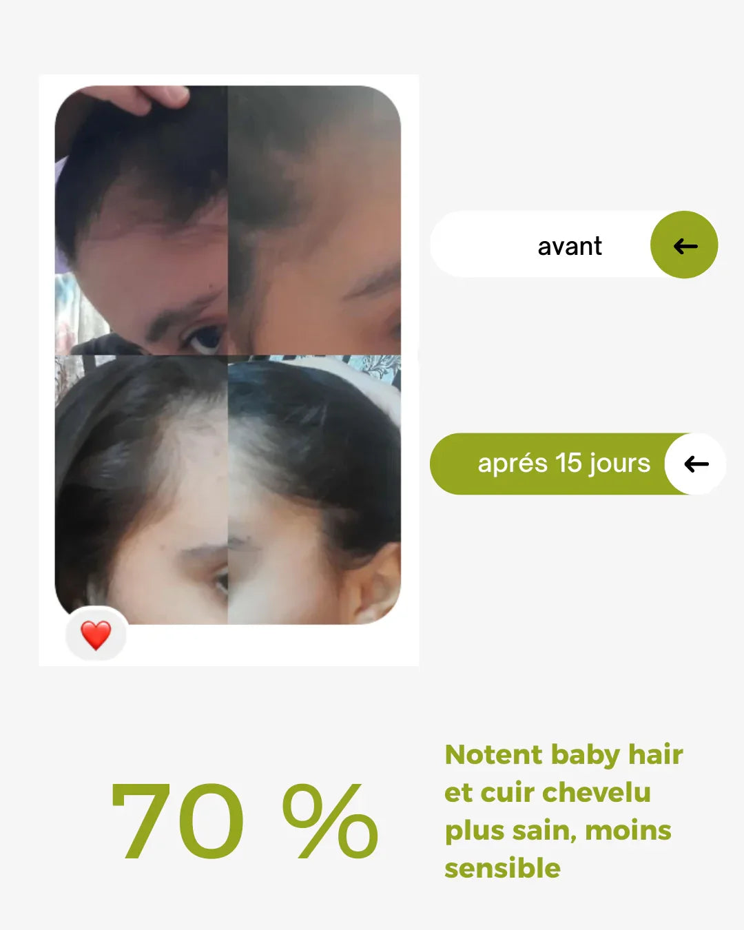 herbal hair growth box