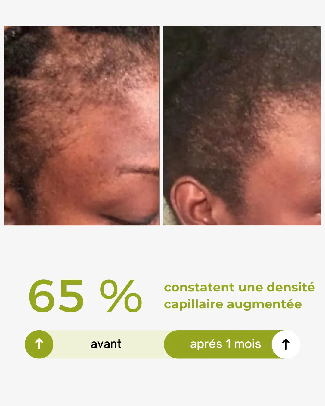 herbal hair growth box