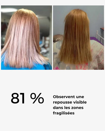 herbal hair growth box